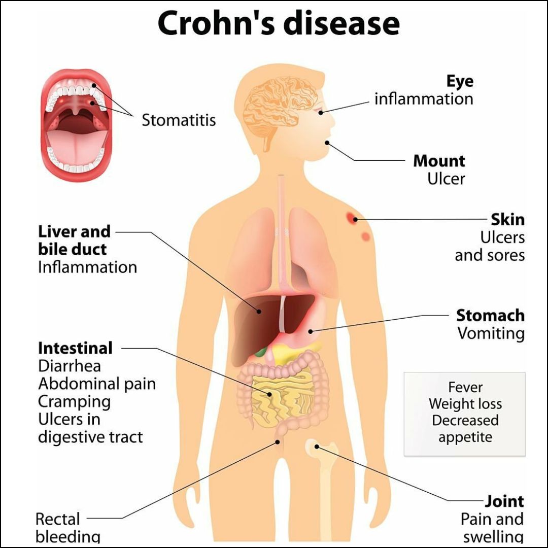 xr:d:DAFybrf3JVE:156,j:843708607465489701,t:23111810